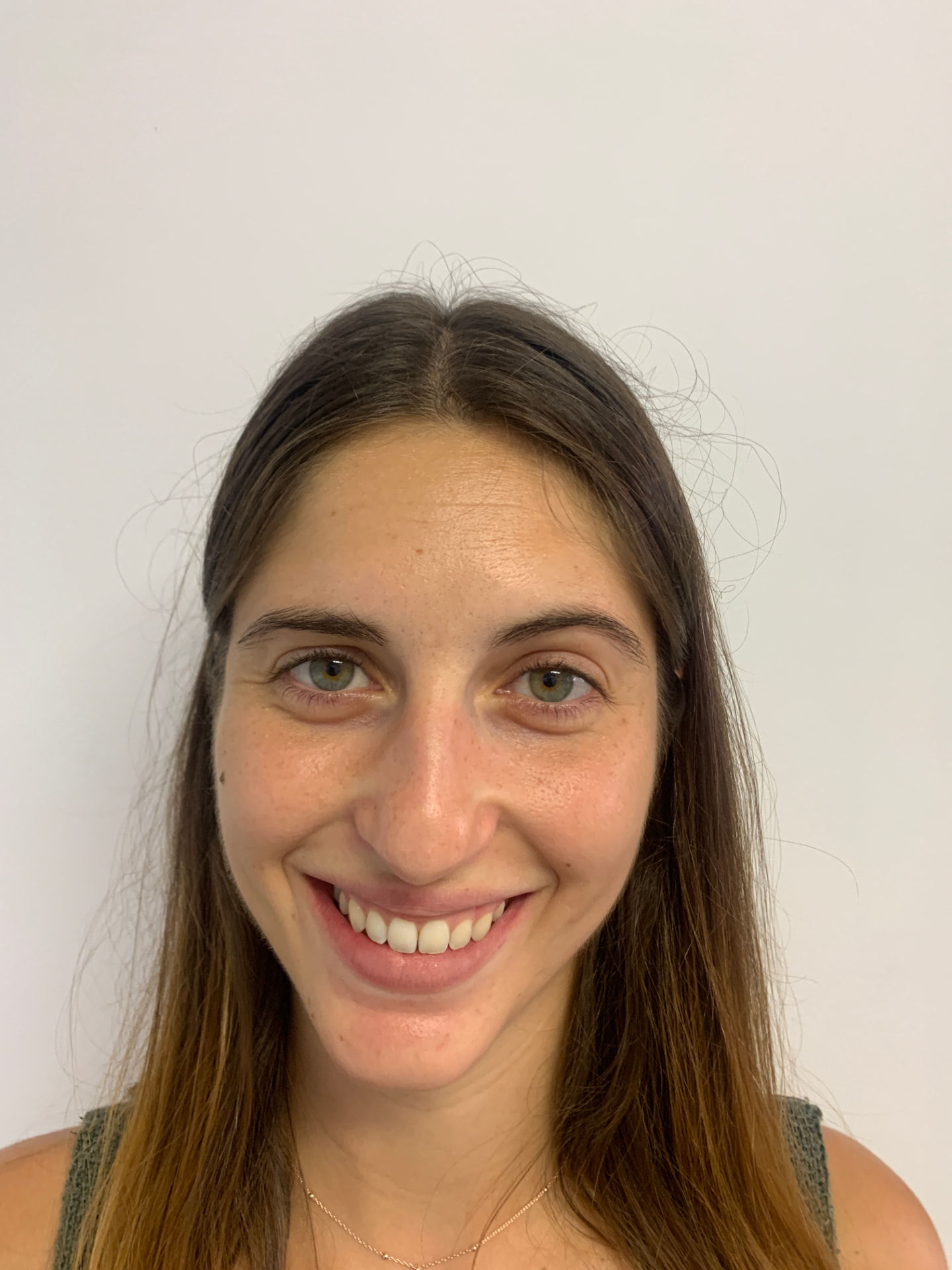 Dolor articular tras brackets: ¿desprogramar la ATM o retratar ya con alineadores?